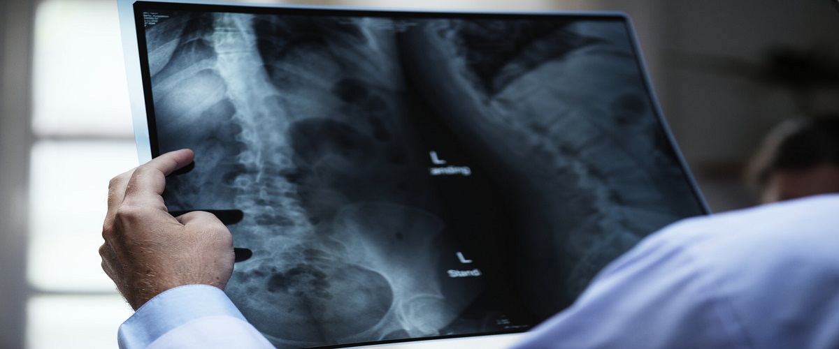 x ray in tolichowki